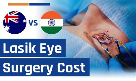 lasik surgery cost australia.